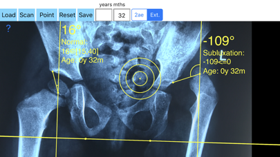 CenterEdgeAngleApp4screenshot