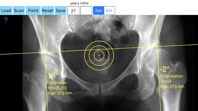 CenterEdgeAngleApp1screenshot