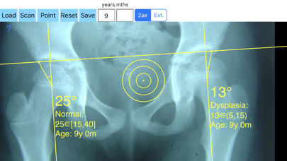 CenterEdgeAngleApp2screenshot