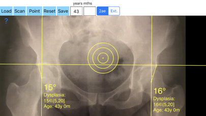 CenterEdgeAngleApp3screenshot